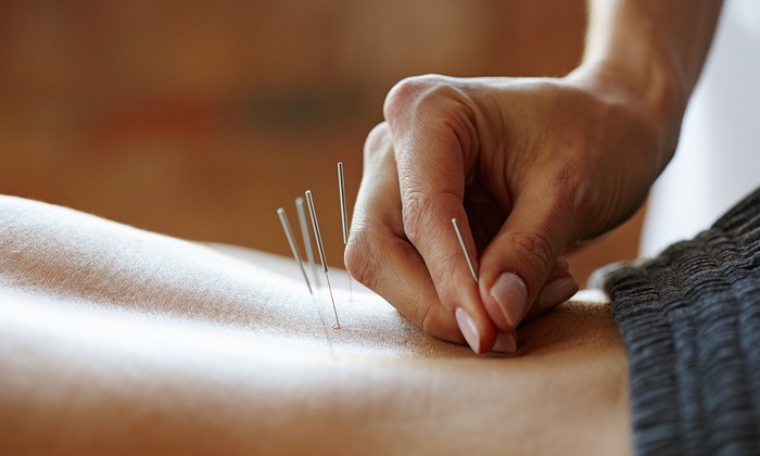 Acupuncture Is An Effective Weight Loss Tool For Adults