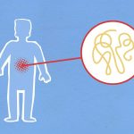 How Gut Health Influences Inflammation