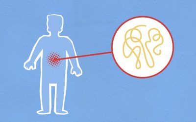 How Gut Health Influences Inflammation